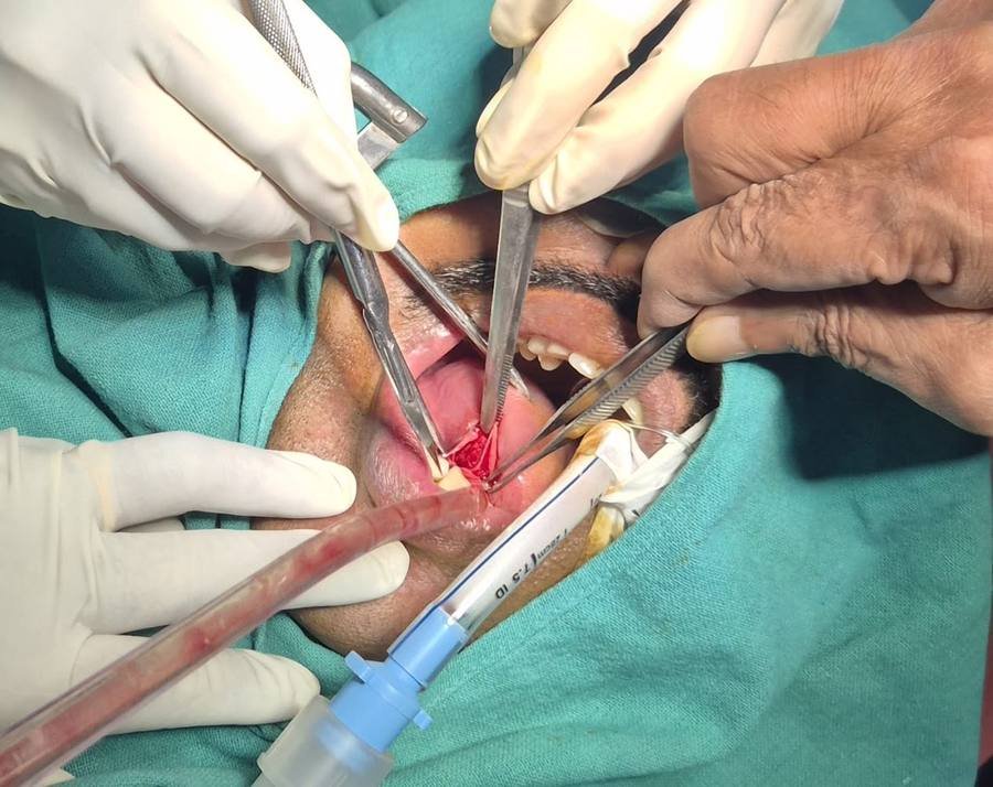 ENT surgery in progress